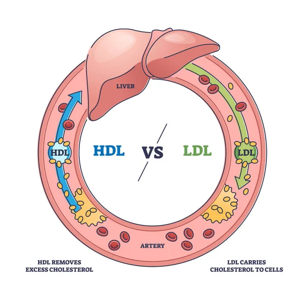 Good Hdl Bad Ldl Cholesterol Movement Comparison Outline Diagram Labeled — Stock Vector