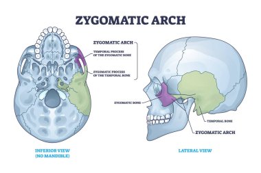 Zygomatic acrh with skull cheekbone skeletal parts anatomy outline diagram. Labeled educational medical scheme with temporal process of bone location from inferior and lateral view vector illustration