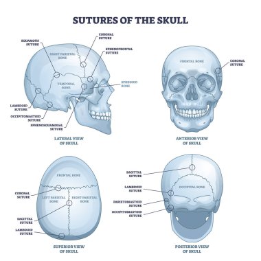 Sutures of the skull as human head bone medical division outline diagram. Labeled educational anatomical scheme with squamous, coronal, lamboid, sagittal and occipitomastoid parts vector illustration.