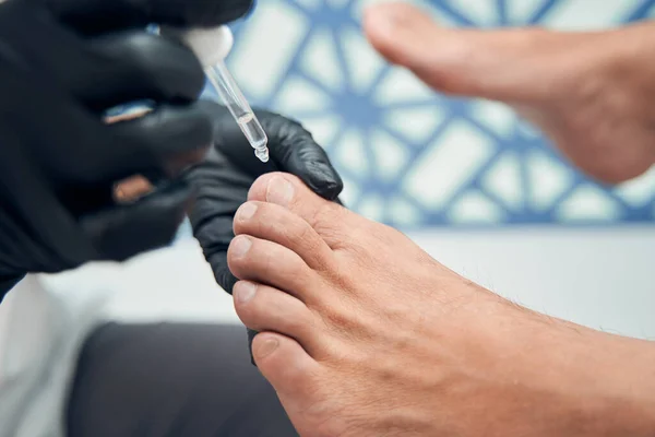 Pedicure master applying serum on man toenail — Stock Photo, Image