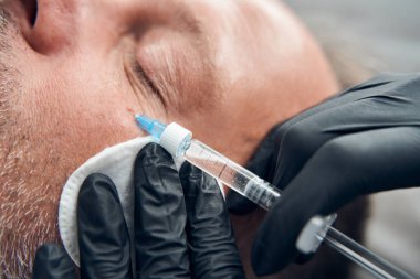 Kozmetik uzmanı elleri erkek yüzüne iğne yapıyor.