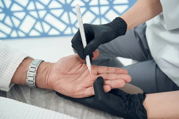 Cosmetologist marking man hand before cosmetic procedure — Stock Photo, Image