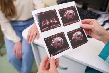 Elinde ultrason resmi olan kadın ellerine odaklanmış bir fotoğraf.