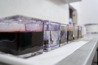 Laboratuvardaki tıbbi malzemelerin yakın plan fotoğrafı.