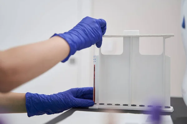 Medical worker at work in the laboratory — Stock Photo, Image