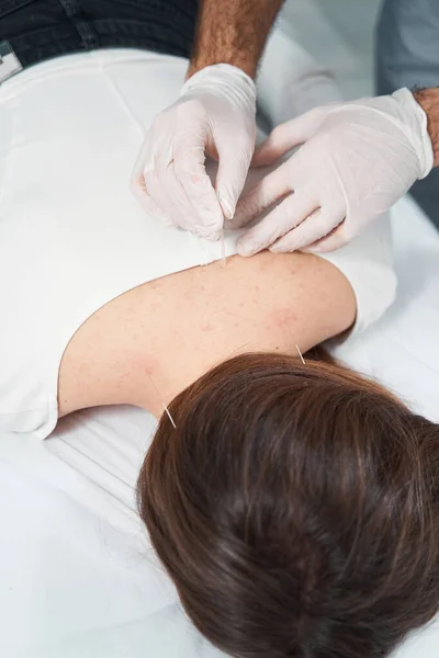 Mujer en sesión de acupuntura para relajar los músculos —  Fotos de Stock