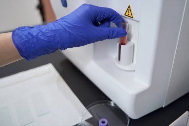 Tıp çalışanı hastanede araştırma için sıvı alıyor.