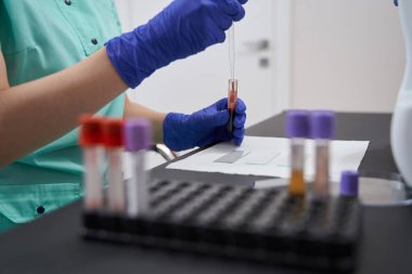 Laboratuvarda testler yapan bir tıp çalışanı.