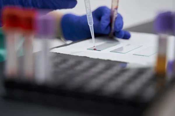 Trabalhador médico profissional fazendo testes em laboratório — Fotografia de Stock