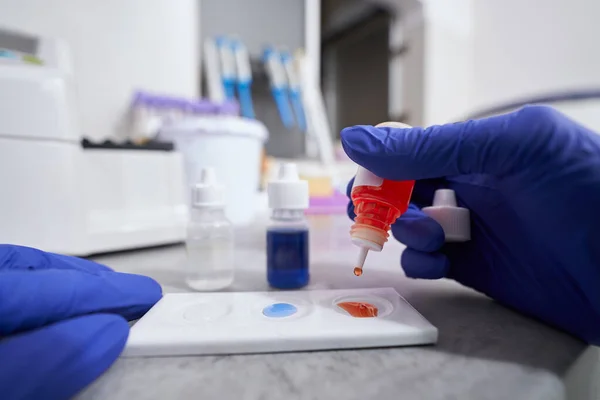 Foto de close-up do teste de fabricação de enfermeiros em laboratório — Fotografia de Stock