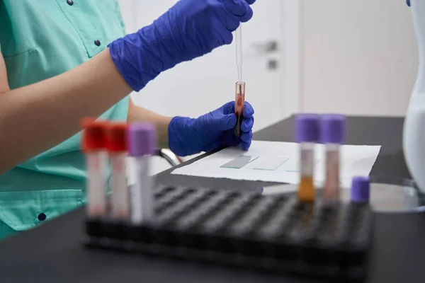 Trabalhador médico fazendo testes em laboratório — Fotografia de Stock