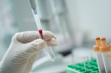 Klinikte kan testi yapan bir doktor.