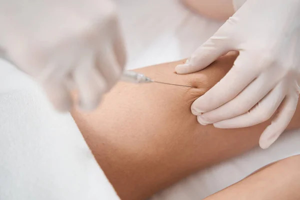 Médico en guantes estériles haciendo inyección en rodilla de mujer —  Fotos de Stock