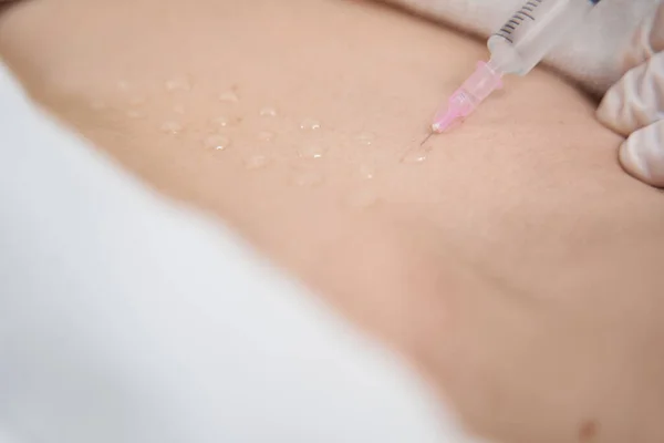 Médico cosmetólogo haciendo inyección en el abdomen del cliente —  Fotos de Stock