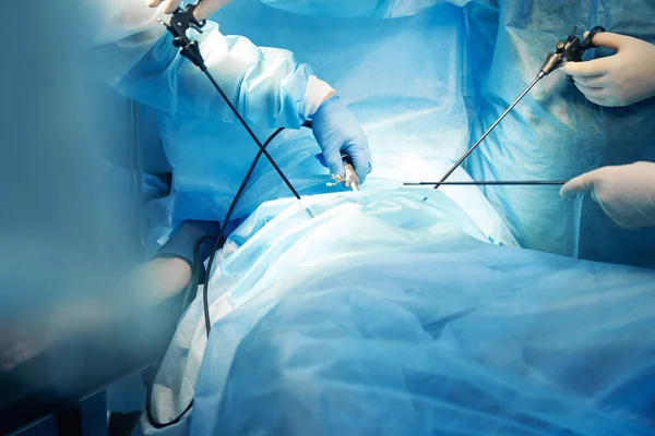 Doktorlar ameliyat yaparken laparoskopik kamera kullanıyorlar. — Stok fotoğraf