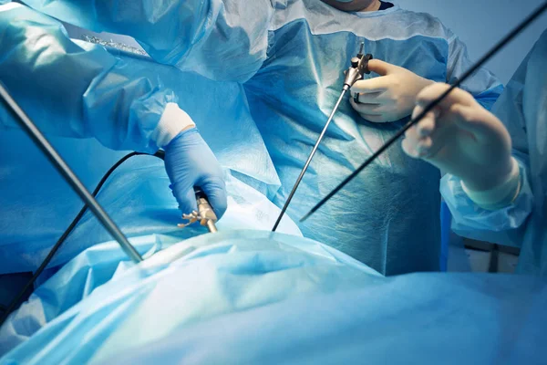 Хирурги, работающие с лапароскопическими инструментами во время операции — стоковое фото