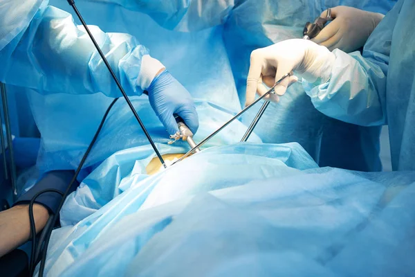 Medical professionals operating on abdomen of patient — Stock Photo, Image