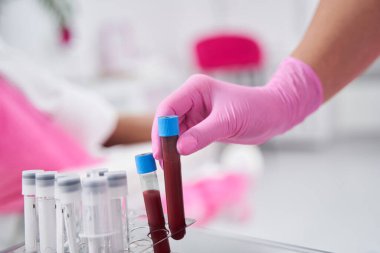Steril koşullarda bir laboratuvar çalışanı bir konteynırı biyolojik malzemeyle dolduruyor.
