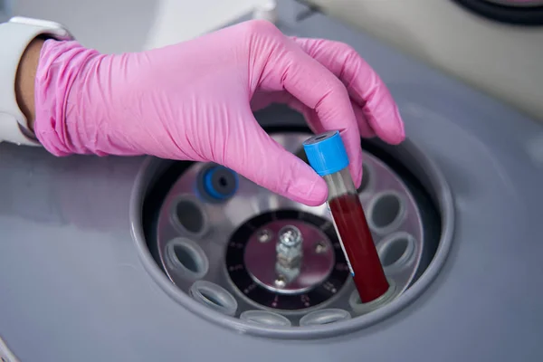 Medizinisches Fachpersonal Vervollständigt Ein Reagenzglas Mit Blut Einem Laborgerät Für — Stockfoto