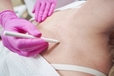 Kesilmiş kafa portresi. Güzellik prosedüründen önce doktorun el yapımı bölge boyun çizgisi.