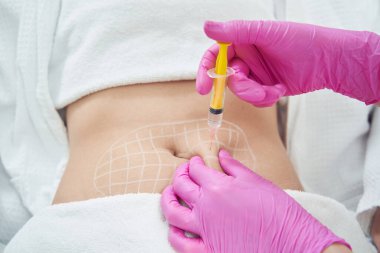 Elinde şırıngayla cilt doktorunun portresi güzellik merkezinde göbeğin altındaki deri altı yağına lipotropik enjeksiyon yapıyor.