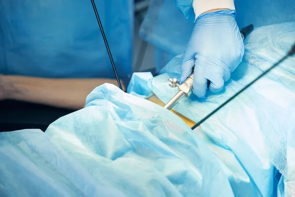 Hand Gynecologist Latex Glove Holding Hysteroscope While Treating Patient — Stock Photo, Image