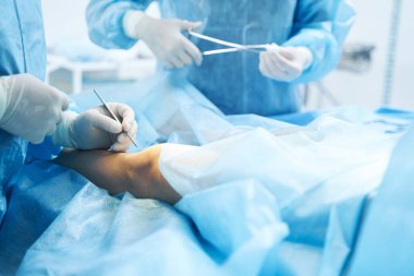 Ameliyat masasında elinde neşter tutan bir doktorla hastanın bacağı.