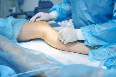 Varisli bir hastanın bacağını kapat ve doktor lazer tedavisi uygula.