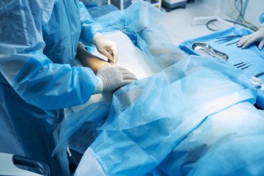 Cerrahi önlüklü tanınmayan bir phlebologist lazer iğnesinin ucuyla hastasının bacağına dokunuyor.