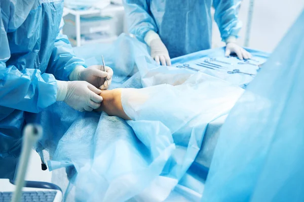 Patient Subissant Traitement Chirurgical Genou Travailleur Médical Utilisant Scalpel Pointu — Photo
