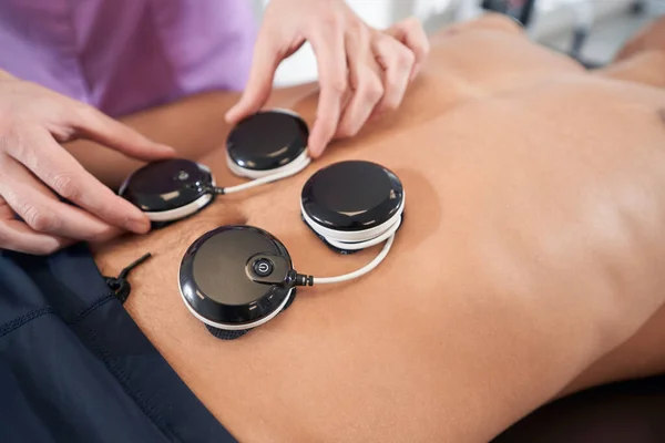 Close Female Doctor Hands Placing Physiotherapy Electrostimulation Device Male Abdomen — Stock Photo, Image
