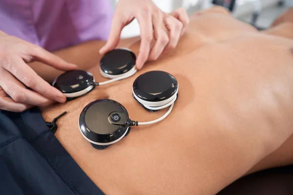 Close Female Doctor Hands Placing Physiotherapy Electrostimulation Device Male Abdomen — Foto de Stock