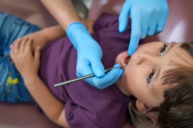 Doctor in nitrile gloves inspecting oral cavity of little patient with dental probe