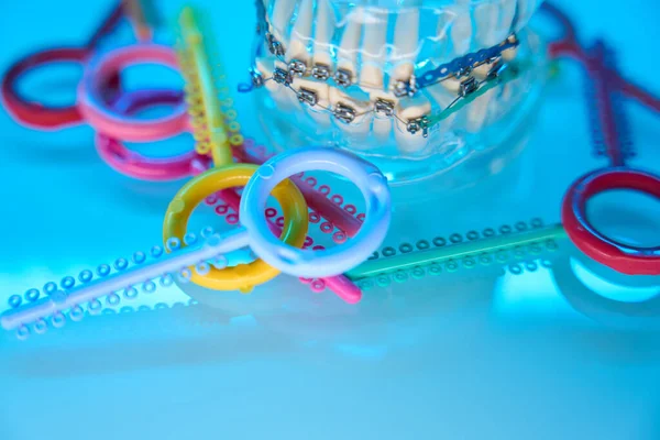 Cropped Photo Jaw Mockup Multicolored Ligature Braces Dental Teeth Alignment — Stock Photo, Image