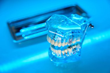 Dişleri ve kök kanalları olan şeffaf insan çene modeli. Ortodontist için araçlar