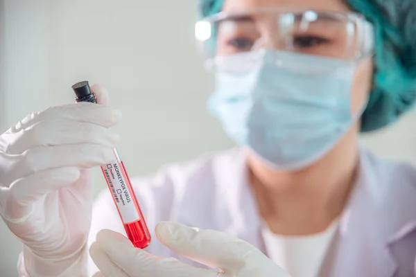 Doctor Scientist Holding Antigen Blood Testing Tube Monkeypox — Stock Fotó