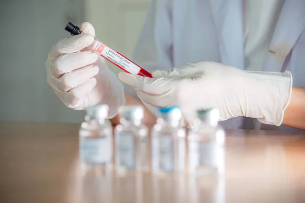 Doctor Scientist Holding Antigen Blood Testing Tube Monkeypox — Stock Fotó