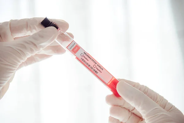 Hand Doctor Holding Blood Testing Tube Monkeypox — Stock Fotó