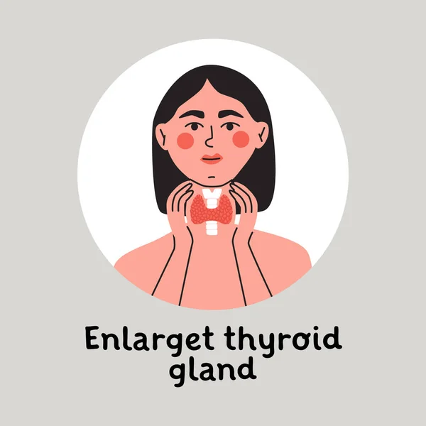 Mujer Mostrando Agrandamiento Glándula Tiroides Cuello Símbolo Del Sistema Endocrinológico — Vector de stock
