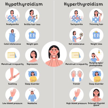 Hipotiroidizm ve hipertiroidizm belirtileri. Endokrinoloji sisteminde tiroid bezi sorunu, hormon üretimi. Kadın karakterli, bilgili. Düz vektör tıbbi illüstrasyon.
