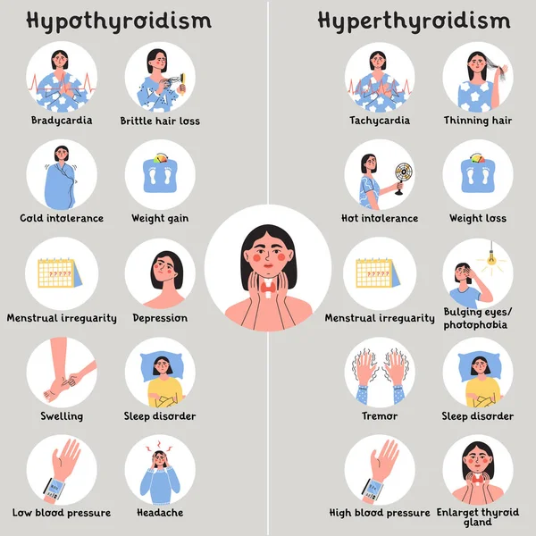 Hipotireoidismo Sintomas Hipertireoidismo Problema Glândula Tireóide Com Sistema Endocrinologia Produção —  Vetores de Stock