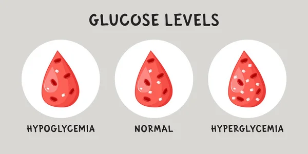 Veren Glukoosipitoisuus Infografiassa Hypoglykemia Hyperglykemia Normaali Verensokeri Tasainen Vektori Lääketieteellinen — vektorikuva