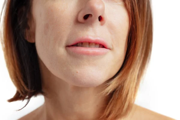 Close-up dipotong wajah perempuan. Mulut, hidung dan dagu. Kosmetologi anti-usia, obat-obatan, kesehatan gigi. Rincian shot. — Stok Foto