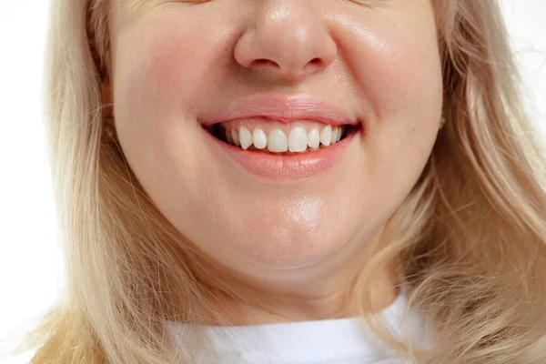 Tutup mulut terbuka wanita tersenyum tanpa makeup bibir. Kosmetologi, obat-obatan, kesehatan gigi. Rincian. — Stok Foto