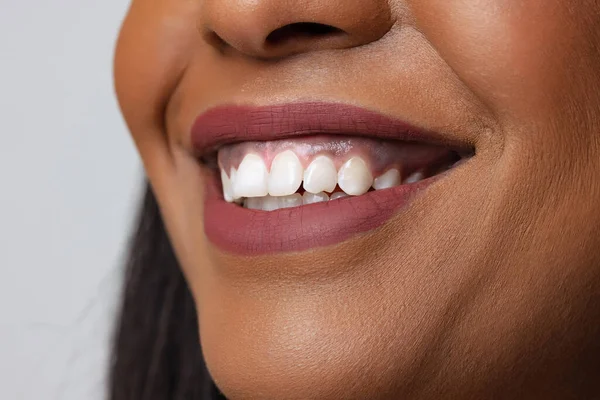 Primeros planos de bellos labios femeninos, boca y dientes rectos blancos aislados en el fondo gris del estudio. Belleza natural —  Fotos de Stock