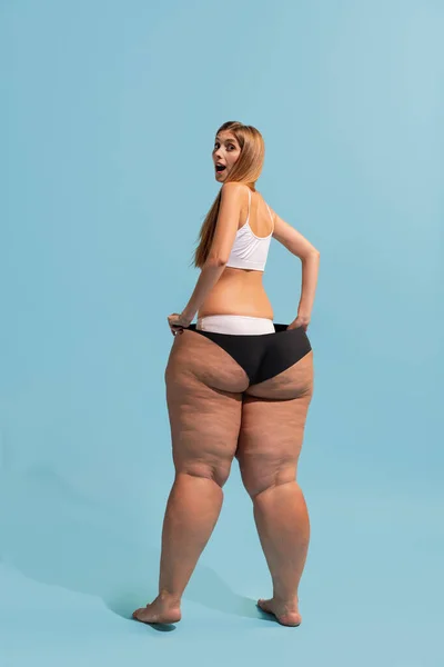 Collage Beautiful Thin Girl Body Size Woman Cellulite Skin Isolated — ストック写真