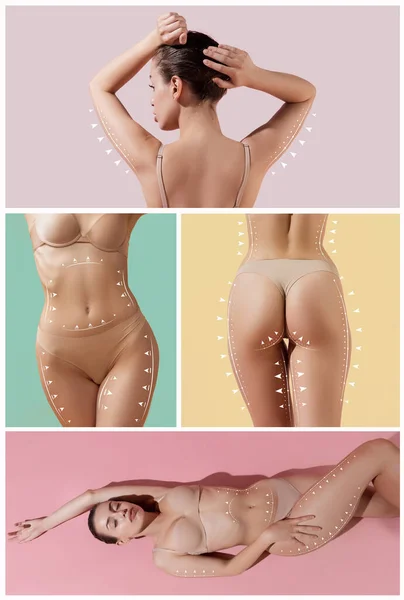 Photo Preset Marks Arrows Womens Hips Belly Plastic Surgery Lifting — Stok fotoğraf