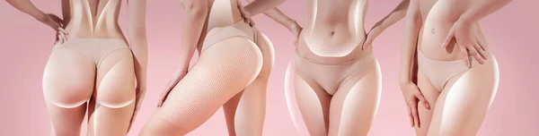 Collage Cropped Images Slim Female Bodies Lifting Lines Pink Background — Photo