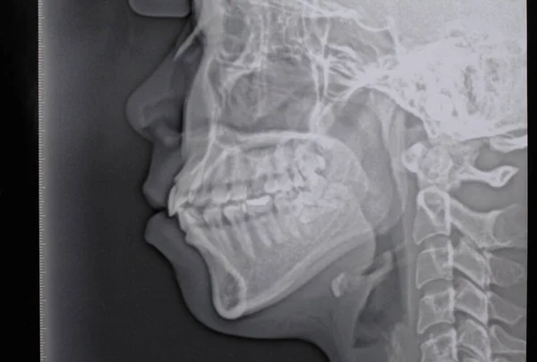 Raio Dental Panorâmico Saudável — Fotografia de Stock