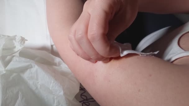 自宅で女性は モル黒色腫の除去のための手術後の傷の外科的ステッチを明らかにし 彼女の腕からバンドエイドを削除するのに苦労 — ストック動画
